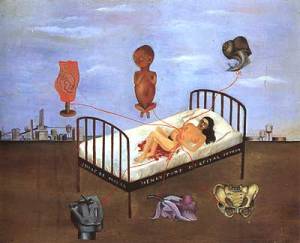 Frida Kahlo Ospedale Henry Ford (o Il letto volante) 1932 Museo Dolores Olmedo Patino Città del Messico